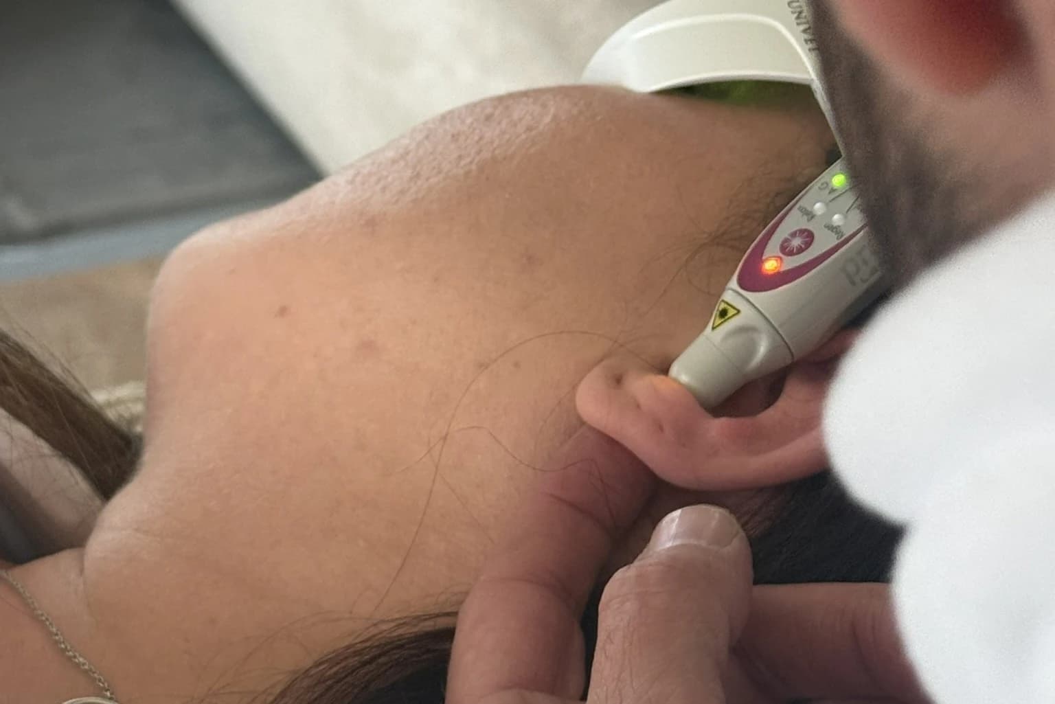 Application du laser auriculaire sur l'oreille d'un patient lors d'une séance de sevrage tabac